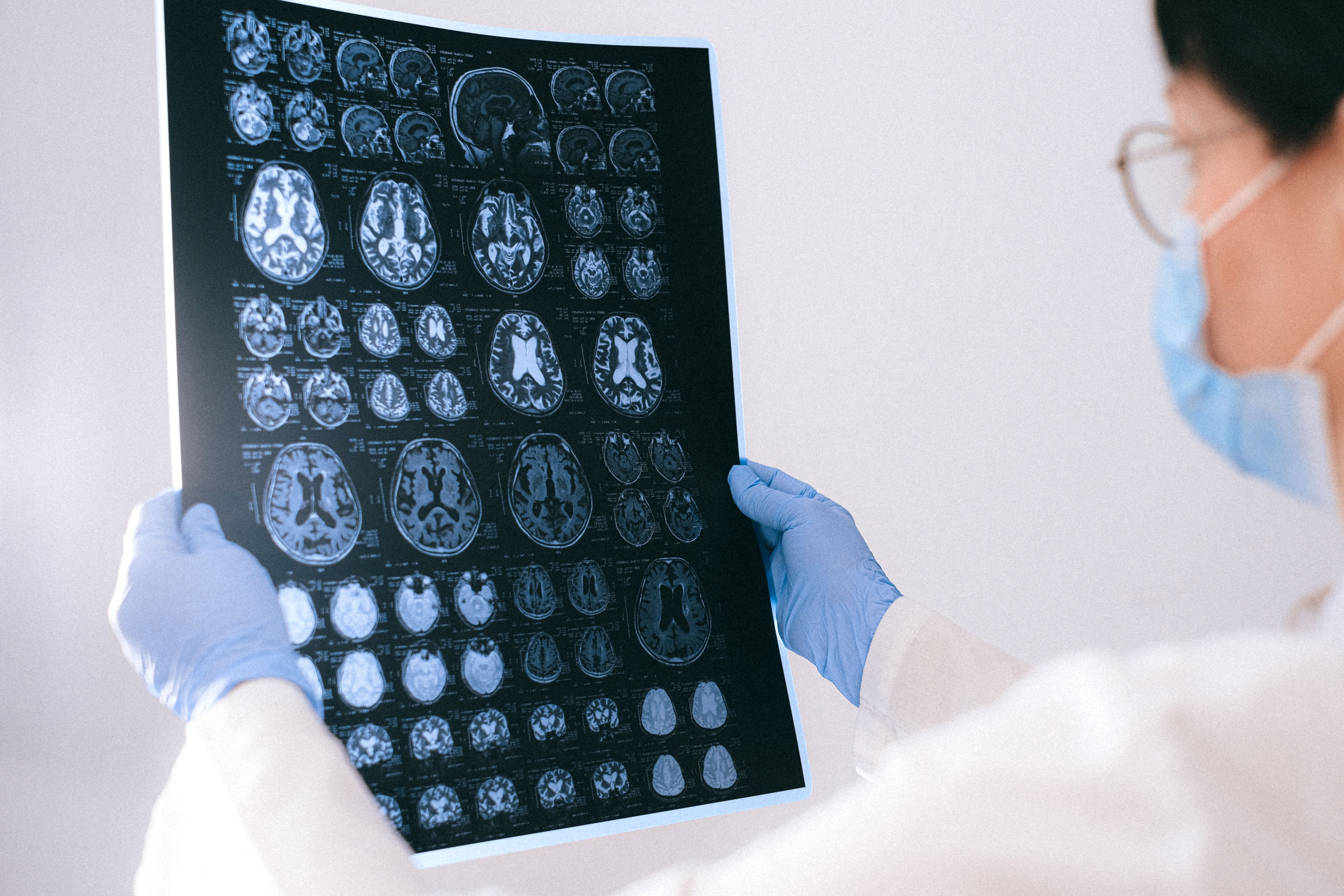 Medical professional reviewing neuroimaging scans in a clinical hospital setting